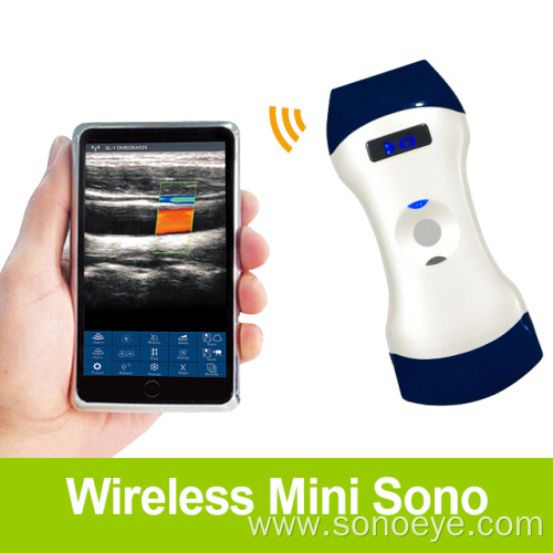 Portable Ultrasound One Year One Million Sales Achievement